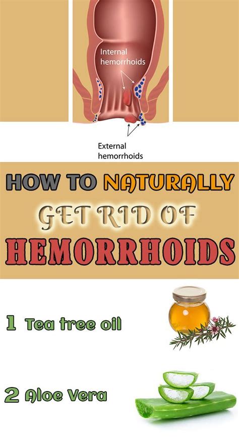 versace hemmoyhoid|The Top 5 Ways to Get Rid of Your Hemorrhoids Fast.